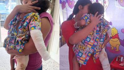 La Dirección Policial de Investigación (DPI) activó este lunes un operativo para dar con el paradero de un hombre acusado de agredir brutalmente a su hijastro en el municipio de Concepción del Norte, departamento de Santa Bárbara.