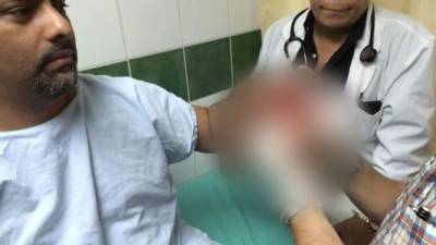 El excandidato y actual regidor de la alcaldía de Tegucigalpa, Rafael Barahona, quien fue atacado a balazos anoche en las cercanías del barrio La Granja. Imagen del momento cuando era atendido en una clínica.