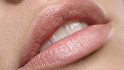 El herpes simplex puede pasarse con un beso.
