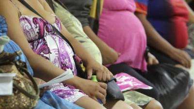 La incidencia de zika en mujeres embarazadas se ha vinculado con casos de microcefalia y otras malformaciones. Archivo.