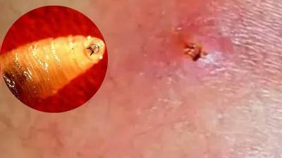 Casos del gusano barrenador.