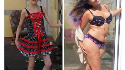 Megan Jayne comenzó a sufrir por problemas de imagen con su cuerpo desde los cinco años. A los 14 fue diagnosticada con anorexia, por lo que se internó en una institución mental para jóvenes antes de ser hospitalizada.