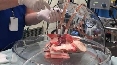 Fotografía cedida por la universidad de Toronto en la que la se registró la intervención de un órgano por parte de investigadores de la Universidad de Sao Paulo, que descubrieron una manera de descontaminar órganos destinados a trasplantes. EFE