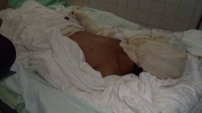 El niño está en vigilancia médica para evitar complicaciones que pongan en riesgo su vida.