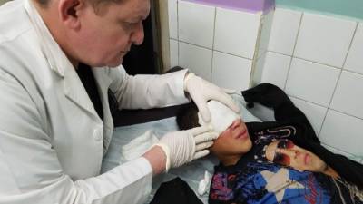 Uno de los menores sufrió quemaduras en el rostro a causa de un volcán.