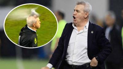 Javier ‘Vasco‘ Aguirre no le puso mucha atención al tema de la agresión que sufrió por el lanzamiento de una lata de cerveza que le hizo una herida en la cabeza.