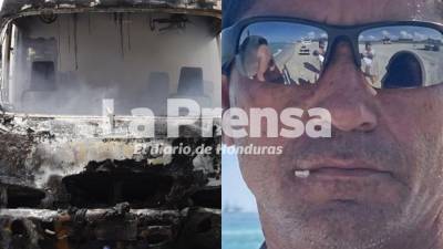 El Hospital Mario Catarino Rivas confirmó el fallecimiento de Sairy Portillo Betancur, de 51 años, quien permanecía en estado crítico desde el pasado jueves 4 de junio tras sufrir un violento accidente de tránsito en el barrio Barandillas, en San Pedro Sula.