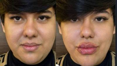 El polémico crítico de moda hondureño y creador de contenido Antonio Sandrez volvió a acaparar la atención en redes sociales, esta vez al presumir sus más recientes retoques estéticos.