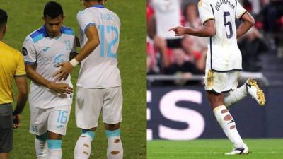 David Ruiz jugó así: La razón por la que los futbolistas usan medias rotas