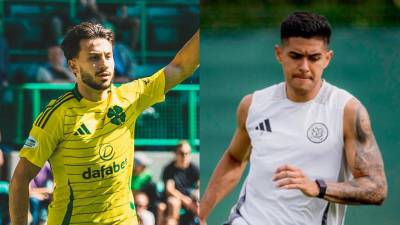 Luis Palma estuvo ausente en el triunfo del Celtic ante el Hibernian por la jornada 2 de la Premier League de Escocia.