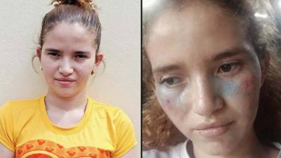 Una hondureña de 23 años fue capturada en la colonia La Unión, en Tegucigalpa, acusada de fingir su propio secuestro en dos ocasiones para obtener dinero de su pareja sentimental y utilizar inteligencia artificial (IA) para fabricar imágenes de lesiones y documentos hospitalarios falsos.
