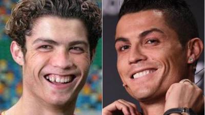 El antes y el después de Cristiano Ronaldo es abismal.