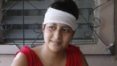 La vida de Hazel Michell Cortés Ruiz cambió intempestivamente hace un mes, cuando fue víctima, junto a un amigo, de un ataque brutal por parte de su exnovio, Fabricio Jared Matute Cabrera. Los pronósticos, relató Hazel a LA PRENSA, no eran favorecedores. Ahora, recuperándose, dice que la vida le concedió un milagro.