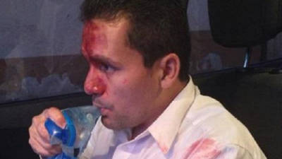 Carlenton Dávila, candidato a alcaldía de Tegucigalpa por el PAC, fue golpeado por desconocidos.