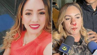 Aún investigan quién agredió a la precandidata.