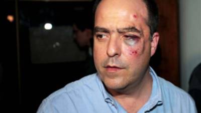 El legislador de oposición Julio Borges llega con la cara golpeada a las oficinas de su partido político, antes de hablar a la prensa en Caracas, el martes 30 de abril de 2013. Un grupo de legisladores oficialistas se enfrentó a golpes con diputados opositores que exigían su derecho de palabra que les fue conculcado por el presidente de la Asamblea Nacional (AP Foto/Fernando Llano)