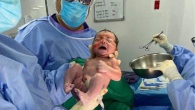 Uno de los bebés que nacieron mediante el procedimiento de fertilización in vitro.