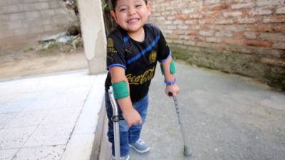 Ángel es un simpático niño que ha logrado su recuperación gracias a la Teletón.