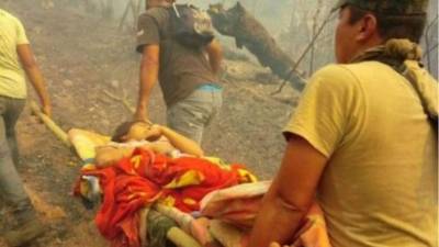 Las niñas quemadas fueron llevadas a Tegucigalpa.