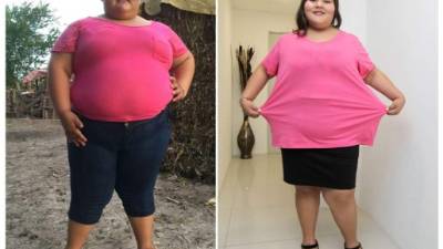 Combo de fotografías de la mexicana Dayana Camacho, de 14 años, la de la izquierda, tomada el 22 de agosto de 2016 y cedida por el Corporativo de Relaciones Públicas MKRP, y la de la derecha, tomada por Efe ayer en Guadalajara, México. EFE