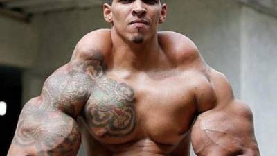 Los músculos de sus brazos crecieron desproporcionadamente por lo que su imprudencia le estuvo a punto de provocar la muerte.