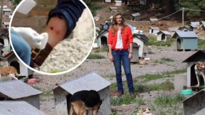 Monserrat Oliver informó en Twitter que no fue necesario que le cosieran la herida