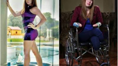 Shirley Meléndez había sido siempre una joven alegre y bastante guapa, pero su vida cambió de la noche a la mañana.