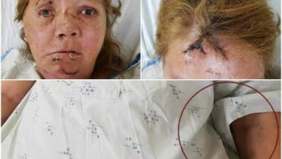 Como Irma de Jesús Muñoz (43) fue identificada una hondureña que recibió una paliza después de que su presunta amiga la atacara brutalmente.
