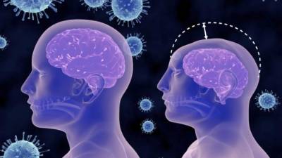 La microcefalia puede afectar el desarrollo del niño.