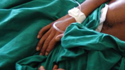 Foto de Archivo. En los casos de erección prolongada, a los pacientes se les practica una cirugía para drenar la sangre acumulada, según fuentes médicas.