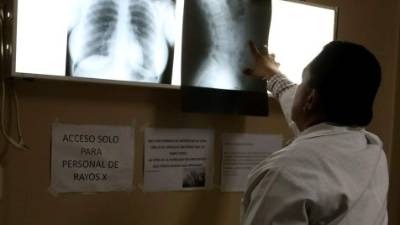 El hospital contaba con tres radiólogos; actualmente no hay ninguno. Foto: Franklyn Muñoz