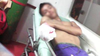 David Carpio es el joven que perdió dos dedos por mortero.