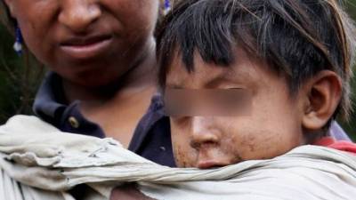 Las poblaciones indígenas del país son las más afectadas por la desnutrición crónica. Foto de archivo.