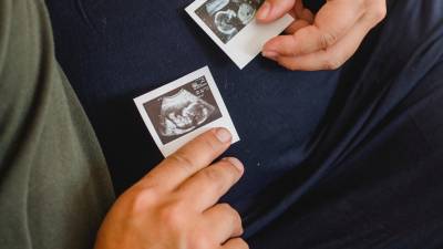 Los investigadores detrás del estudio y otros <b>científicos </b>destacan que las estructuras creadas no deben considerarse <b>embriones humanos.</b>