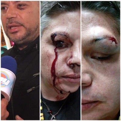Reportera de Televisa denuncia agresión en México