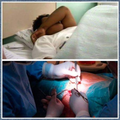 Hombre que se cortó sus genitales es dado de alta