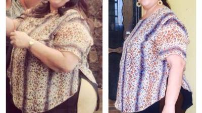 Genoveva Grande es una paciente operada en el IHSS hace casi dos meses y ha perdido 55 libras.