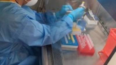Esta semana harán 600 pruebas rápidas en municipios de Cortés. Esperan también llegar a las 200 PCR en el nuevo laboratorio.