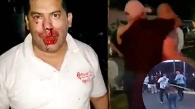 Miguel Briceño, diputado del Partido Libertad y Refundación (Libre), fue uno de los agredidos.