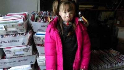 La pequeña Sa'fyre Terry quedó con quemaduras en más del 75% de su cuerpecito.