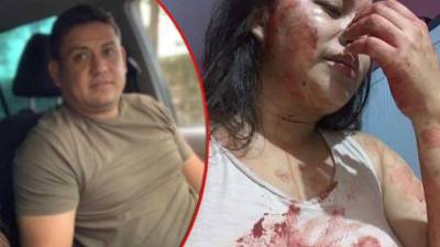 Foto de José Fredy Luna y Lisbany León.