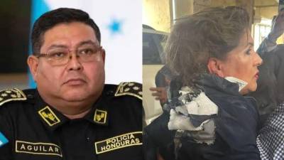 El director de la Policía Nacional de Honduras, Juan Manuel Aguilar Godoy, se pronunció este viernes sobre el ataque ocurrido el jueves 8 de enero contra la diputada del Partido Nacional, Gladis Aurora López, en los bajos del Congreso Nacional.