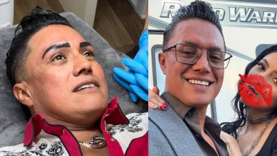 Erik Roberto, mejor conocido como El Charro o El Charrito, sigue dando de qué hablar en sus redes sociales. Y es que en las últimas semanas el creador de contenido se ha sometido a cirugías y retoques estéticos.