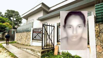 Norma Aracely Quintanilla sufrió quemaduras de cuarto grado.