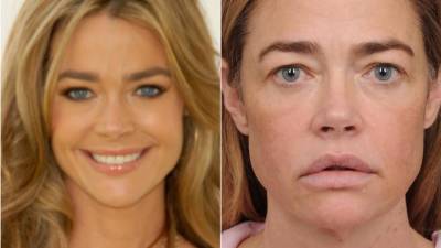 Denise Richards conquistó al mundo con la película Starship Troopers, con sus ojos azules, cejas marcadas y capas desfiladas que definieron los 90. En cierto modo, ella definió la década: de los 90, fue un símbolo sexual, estrella de Wild Things, chica Bond y tuvo cameos en casi todas las series que marcaron la época: Seinfeld, Beverly Hills 90210, Saved by the Bell, Melrose Place y Married... with Children.
