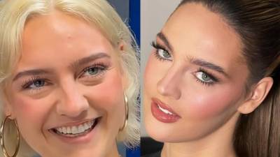 Clara Vegas Goetz, Miss Venezuela 2025, ha captado la atención de los seguidores de los certámenes de belleza por la evolución de su imagen durante su preparación para Miss Universo 2026. El cambio de color de cabello, una figura más tonificada y las modificaciones que se aprecian en sus facciones han despertado comentarios en redes sociales, donde muchos comparan su apariencia actual con la que lucía al inicio de su reinado.