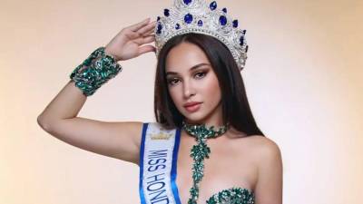 Inteligencia, disciplina y una firme vocación de servicio son algunos de los atributos con los que Stephanie Guifarro busca abrirse camino hacia la corona del Miss Honduras Universo 2025. La representante de Santa Bárbara aspira a convertirse en la próxima embajadora de la belleza hondureña y llevar el nombre del país al escenario de Miss Universo.