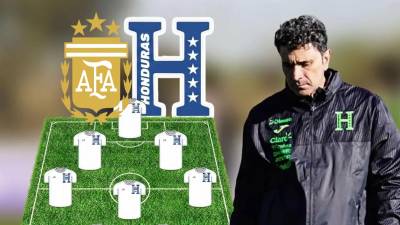 La Selección de Honduras afronta este sábado un nuevo reto de la mano de José Francisco Molina y lo harán ante la actual campeona del mundo, Argentina.