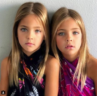 Las gemelas más bellas del mundo