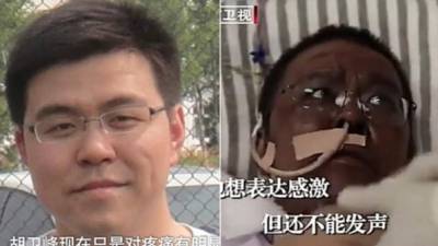 El doctor Hu Weifeng permaneció tres semanas conectado a un respirador artificial. Su piel se tornó oscura tras salir del coma./Twitter.